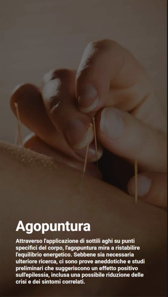 Foto di una mano che applica aghi sottili sulla pelle, con descrizione dell’agopuntura come terapia complementare per l’epilessia.