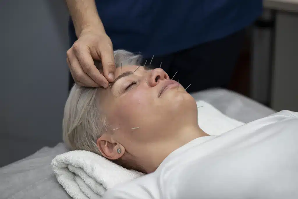 Trattamento di agopuntura sulla faccia di una persona sdraiata, con il terapeuta che inserisce sottili aghi in un ambiente rilassante.