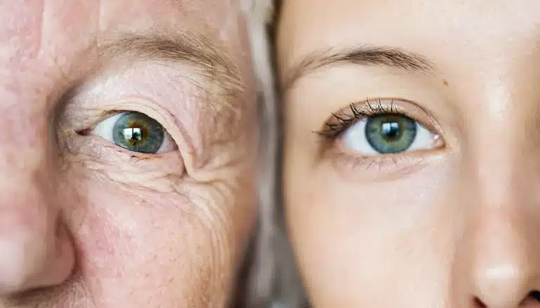 CBD anti invecchiamento